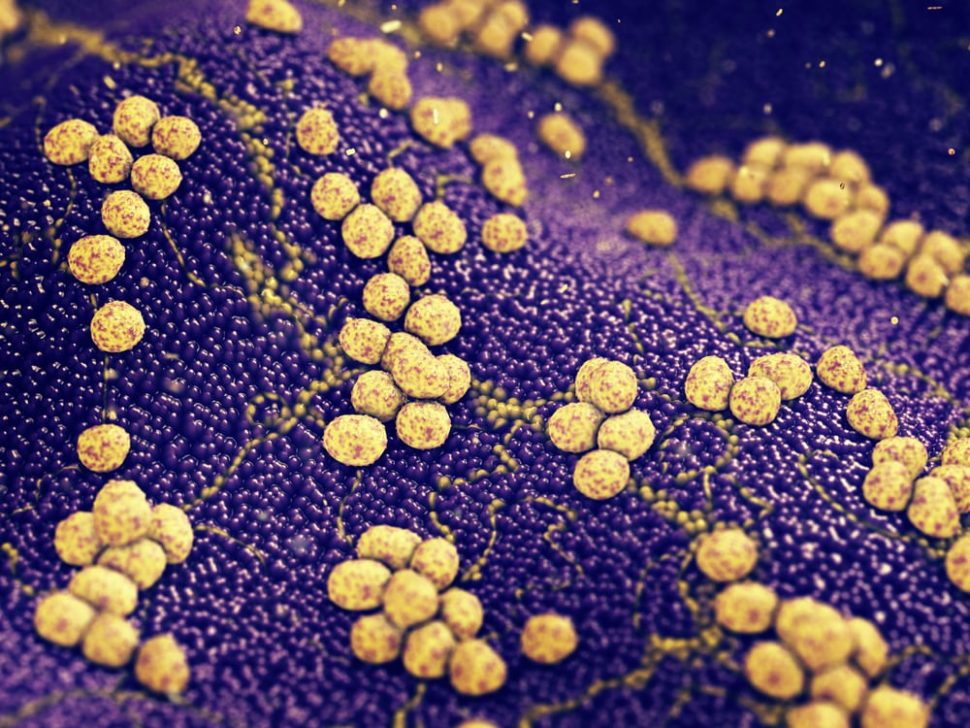 MRSA, one of the world's most dangerous superbugs, could soon be curable. | Image By nobeastsofierce | Shutterstock