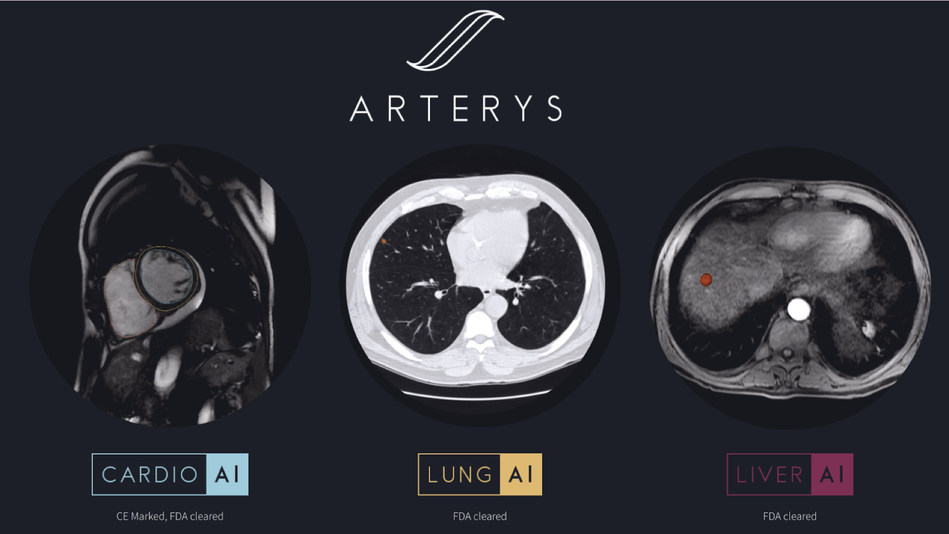Arterys expands its clinical offerings with two new AI-powered workflows for medical imaging interpretation ¦ Image via Arterys