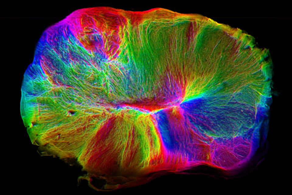 Lab-grown mini brains or cerebral organoids could be used to study human brain development and how brain diseases form | MRC Laboratory